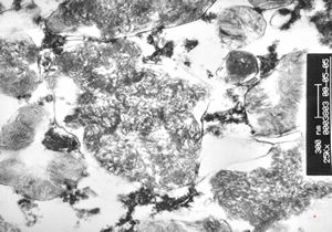 M, 8y. | ceroid-lipofuscinosis - brain M, 8y. | ceroid-lipofuscinosis - brain